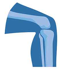 Zdrowie stawów i kości