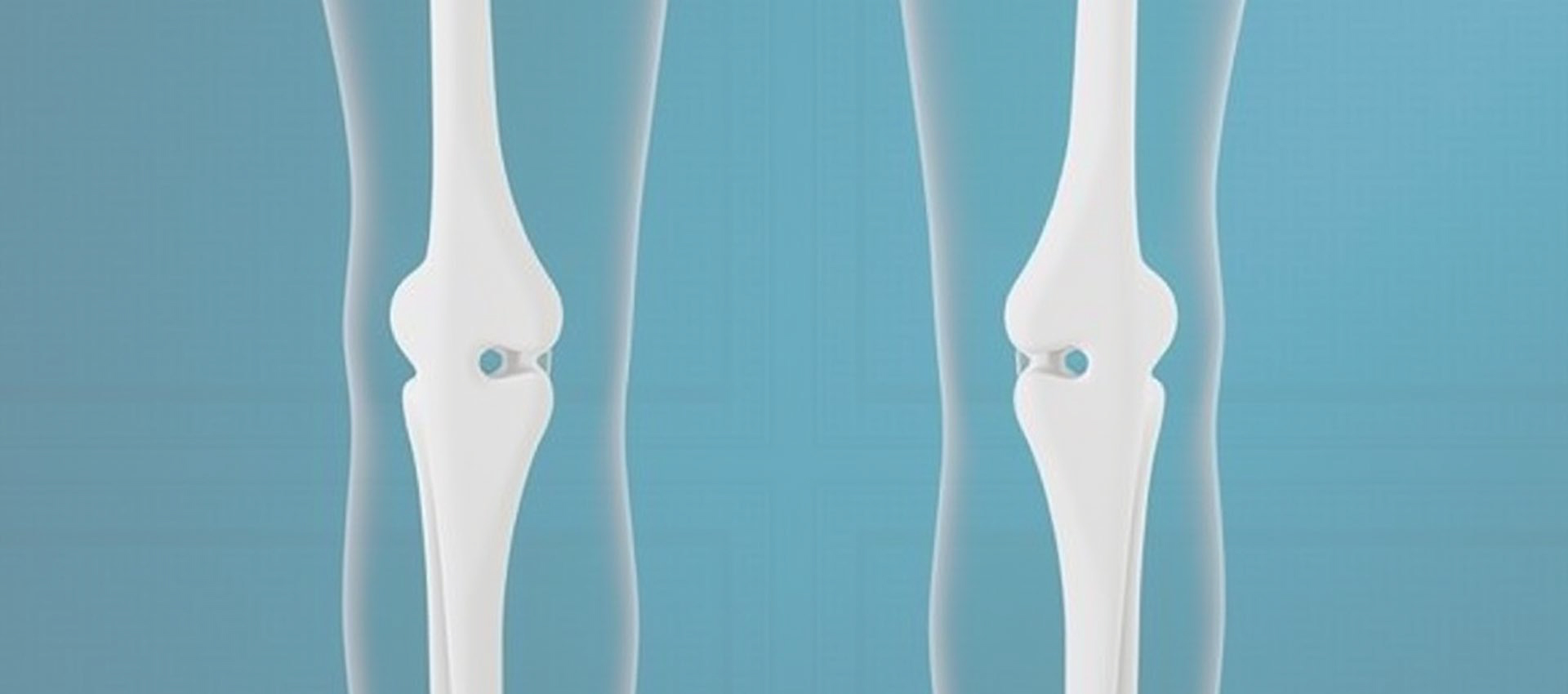 Liposomalna witamina D3