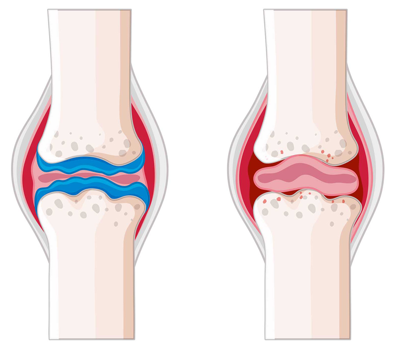 Promuje zdrowie kości i układu krążenia